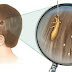VIDEO] Cheap Way to Get Rid of Head Lice that Doctors Won’t Tell You